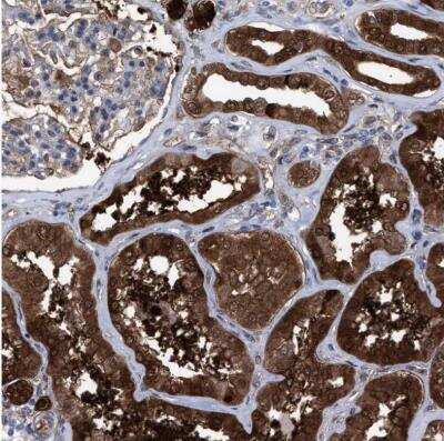 Immunohistochemistry-Paraffin: PIG3 Antibody [NBP1-87275] - Staining of human kidney shows strong cytoplasmic positivity in cells in tubules.