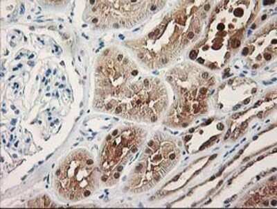 Immunohistochemistry: PIG3 Antibody (OTI3B11) - Azide and BSA Free [NBP2-73400] - Staining of paraffin-embedded Human Kidney tissue using anti-PIG3 mouse monoclonal antibody.
