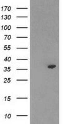 Western Blot: PIG3 Antibody (OTI3B11) - Azide and BSA Free [NBP2-73400] - HEK293T cells were transfected with the pCMV6-ENTRY control (Left lane) or pCMV6-ENTRY PIG3 (Right lane) cDNA for 48 hrs and lysed. Equivalent amounts of cell lysates (5 ug per lane) were separated by SDS-PAGE and immunoblotted with anti-PIG3.