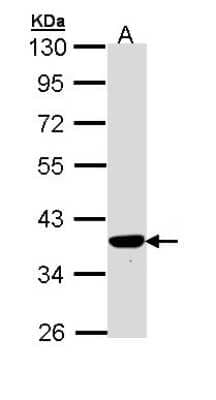 Western Blot: PIG3 Antibody [NBP1-33237] - Sample (30 ug of whole cell lysate) A: Hep G2 10% SDS PAGE; antibody diluted at 1:1000.