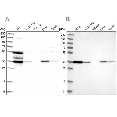 Western Blot: PIG3 Antibody [NBP1-87274] - Analysis using Anti-TP53I3 antibody NBP1-87274 (A) shows similar pattern to independent antibody NBP1-87275 (B).