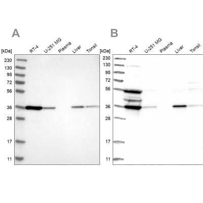 Western Blot: PIG3 Antibody [NBP1-87275] - Analysis using Anti-TP53I3 antibody NBP1-87275 (A) shows similar pattern to independent antibody NBP1-87274 (B).