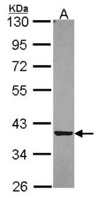 Western Blot: PIG3 Antibody [NBP2-19826] - Sample (30 ug of whole cell lysate) A: A549 10% SDS PAGE gel, diluted at 1:5000.