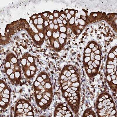 Immunohistochemistry-Paraffin: PIGN Antibody [NBP1-81249] - Staining of human rectum shows strong cytoplasmic positivity in glandular cells.