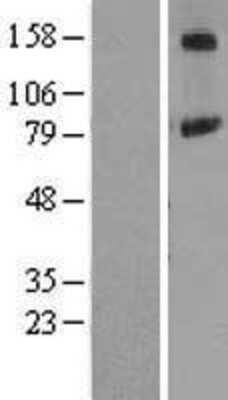 Western Blot: PIGN Overexpression Lysate (Adult Normal) [NBL1-14402] Left-Empty vector transfected control cell lysate (HEK293 cell lysate); Right -Over-expression Lysate for PIGN.