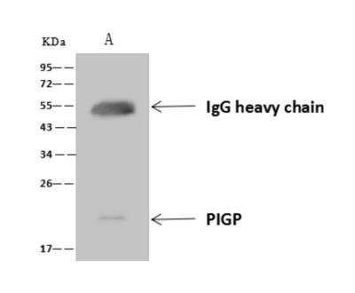 Immunoprecipitation: PIGP Antibody [NBP3-06346] - PIGP was immunoprecipitated using:Lane A: 0.5 mg U87MG Whole Cell Lysate4 uL anti-PIGP rabbit polyclonal antibody and 60 ug of Immunomagnetic beads Protein AG. Primary antibody:Anti-PIGP rabbit polyclonal antibody, at 1:100 dilution Secondary antibody:Goat Anti-Rabbit IgG (H+L) HRP  at 110000 dilutionDeveloped using the ECL technique.Performed under reducing conditions.Predicted band size: 20 kDaObserved band size :20 kDa