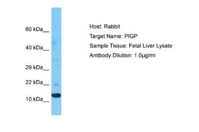 Western Blot PIGP Antibody - BSA Free