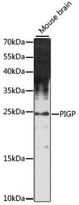 Western Blot: PIGP Antibody [NBP2-94792] - Analysis of extracts of mouse brain, using PIGP .Exposure time: 90s.