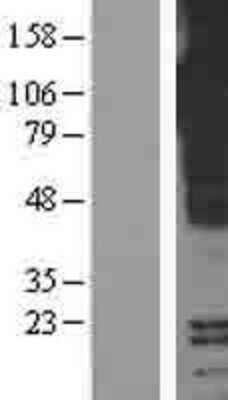 Western Blot pIgR Overexpression Lysate