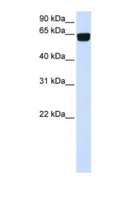 Western Blot: PIGT Antibody [NBP1-69642] - This Anti-PIGT antibody was used in Western Blot of Transfected 293T tissue lysate at a concentration of 1ug/ml.