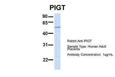Western Blot: PIGT Antibody [NBP1-69642] - Human Adult Placenta, Antibody Dilution: 1.0 ug/ml.