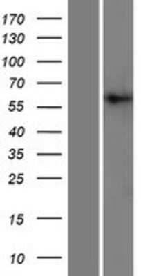 Western Blot: PIGT Overexpression Lysate (Adult Normal) [NBP2-07107] Left-Empty vector transfected control cell lysate (HEK293 cell lysate); Right -Over-expression Lysate for PIGT.