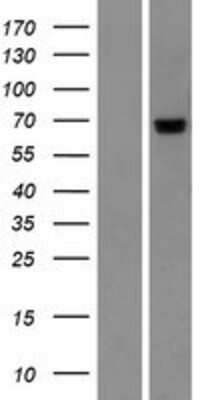 Western Blot: PIGT Overexpression Lysate (Adult Normal) [NBP2-10256] Left-Empty vector transfected control cell lysate (HEK293 cell lysate); Right -Over-expression Lysate for PIGT.