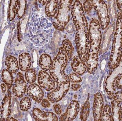 Immunohistochemistry: PIGU Antibody [NBP2-30386] - Staining of human kidney shows strong cytoplasmic positivity, seen with a granular pattern, in renal tubules.