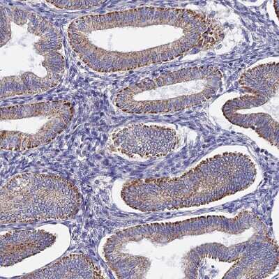 Immunohistochemistry-Paraffin PIGU Antibody