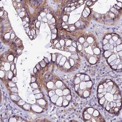 Immunohistochemistry-Paraffin PIGU Antibody