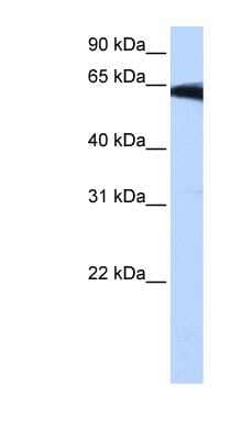 Western Blot: PIGW Antibody [NBP1-60017] - NTERA2 cell lysate, concentration 0.2-1 ug/ml.