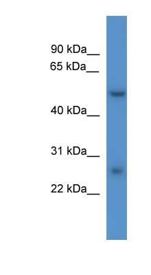 Western Blot: PIGW Antibody [NBP1-79309] - Titration: 0.2-1 ug/ml, Positive Control: Rat Liver.