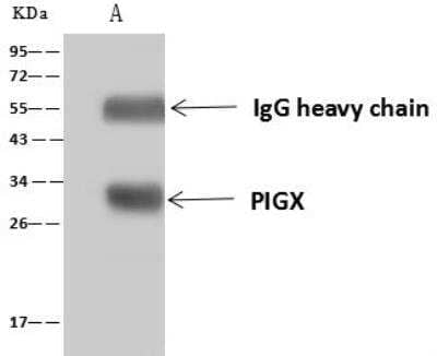 Immunoprecipitation: PIGX Antibody [NBP3-12593] - Lane A:0.5 mg Jurkat Whole Cell Lysate4 uL anti-PIGX rabbit polyclonal antibody and 60 ug of Immunomagnetic beads Protein A/G.Primary antibody:Anti-PIGX rabbit polyclonal antibody,at 1:100 dilution Secondary antibody:Goat Anti-Rabbit IgG (H+L)/HRP at 1/10000 dilutionDeveloped using the ECL technique.Performed under reducing conditions.Predicted band size: 29 kDaObserved band size :29 kDa
