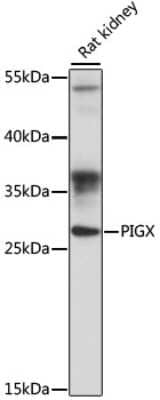 Western Blot: PIGX Antibody [NBP2-94805] - Analysis of extracts of rat kidney, using PIGX at 1:1000 dilution.Secondary antibody: HRP Goat Anti-Rabbit IgG (H+L) at 1:10000 dilution.Lysates/proteins: 25ug per lane.Blocking buffer: 3% nonfat dry milk in TBST.Detection: ECL Basic Kit .Exposure time: 90s.