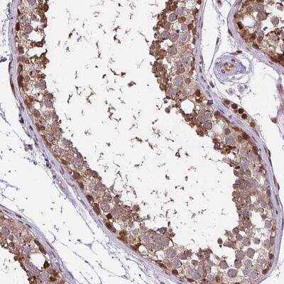 Immunohistochemistry-Paraffin PIGY Antibody - BSA Free