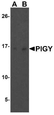 Western Blot: PIGY Antibody [NBP1-77340] - Analysis of PIG-Y in human liver tissue lysate with PIG-Y antibody at (A) 1 and (B) 2 ug/mL.