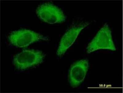 Immunocytochemistry/Immunofluorescence: PIH1D1 Antibody (1G6) [H00055011-M04] - Analysis of monoclonal antibody to FLJ20643 on HeLa cell. Antibody concentration 10 ug/ml