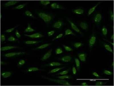 Immunocytochemistry/Immunofluorescence: PIH1D1 Antibody (4F5-1E10) [H00055011-M01] - Analysis of monoclonal antibody to PIH1D1 on HeLa cell . Antibody concentration 10 ug/ml.