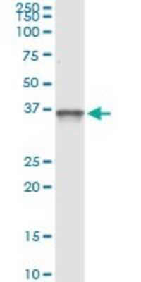 Immunoprecipitation: PIH1D1 Antibody (4F5-1E10) [H00055011-M01] - Analysis of PIH1D1 transfected lysate using anti-PIH1D1 monoclonal antibody and Protein A Magnetic Bead, and immunoblotted with PIH1D1 MaxPab rabbit polyclonal antibody.