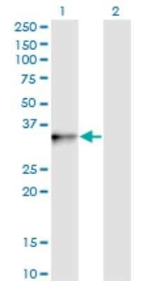 Western Blot: PIH1D1 Antibody (4F5-1E10) [H00055011-M01] - Analysis of PIH1D1 expression in transfected 293T cell line by FLJ20643 monoclonal antibody (M01), clone 4F5-1E10.Lane 1: PIH1D1 transfected lysate (Predicted MW: 32.4 KDa).Lane 2: Non-transfected lysate.