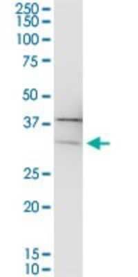 Western Blot: PIH1D1 Antibody [H00055011-B01P] - Analysis of PIH1D1 expression in IMR-32.