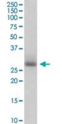 Western Blot: PIH1D1 Antibody [H00055011-B01P] - Analysis of PIH1D1 expression in human lung cancer.