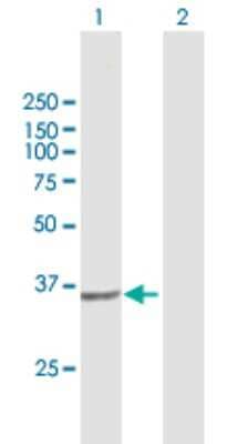 Western Blot: PIH1D1 Antibody [H00055011-B01P] - Analysis of PIH1D1 expression in transfected 293T cell line by PIH1D1 polyclonal antibody.  Lane 1: FLJ20643 transfected lysate(31.9 KDa). Lane 2: Non-transfected lysate.