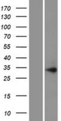 Western Blot: PIH1D1 Overexpression Lysate (Adult Normal) [NBP2-06900] Left-Empty vector transfected control cell lysate (HEK293 cell lysate); Right -Over-expression Lysate for PIH1D1.