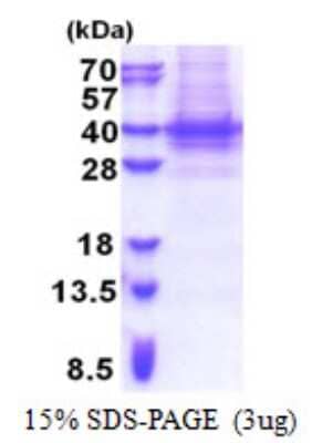 SDS-Page: Recombinant Human PIH1D1 Protein [NBP2-23332]