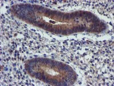 Immunohistochemistry: PIH1D2 Antibody (OTI4A10) - Azide and BSA Free [NBP2-73403] - Staining of paraffin-embedded Human endometrium tissue using anti-PIH1D2 mouse monoclonal antibody.