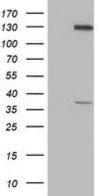 Western Blot: PIH1D2 Antibody (OTI4A10) - Azide and BSA Free [NBP2-73403] - HEK293T cells were transfected with the pCMV6-ENTRY control (Left lane) or pCMV6-ENTRY PIH1D2 (Right lane) cDNA for 48 hrs and lysed. Equivalent amounts of cell lysates (5 ug per lane) were separated by SDS-PAGE and immunoblotted with anti-PIH1D2.