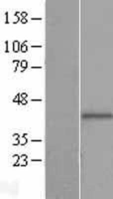 Western Blot: PIH1D2 Overexpression Lysate (Adult Normal) [NBL1-14413] Left-Empty vector transfected control cell lysate (HEK293 cell lysate); Right -Over-expression Lysate for PIH1D2.
