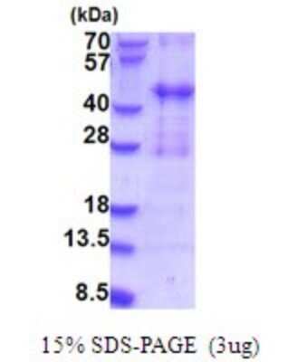 SDS-Page: PIH1D2 Recombinant Protein [NBP2-51879] - 15% SDS Page (3 ug)