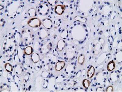 Immunohistochemistry-Paraffin BCAP/PIK3AP1 Antibody (OTI7A11)