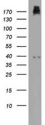 Western Blot: PIK3C2A Antibody (OTI3H2) - Azide and BSA Free [NBP2-73405] - Analysis of HT29 cell lysate (35ug) by using PIK3C2A monoclonal antibody.