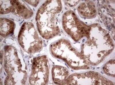 Immunohistochemistry: PIK3CA Antibody (6D9) [NBP2-46403] - Analysis of Human Kidney tissue. (Heat-induced epitope retrieval by 1 mM EDTA in 10mM Tris, pH8.5, 120C for 3min)