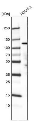 Western Blot: PIK3CA Antibody (CL8345) [NBP3-05502] - Analysis in human cell line HDLM-2.