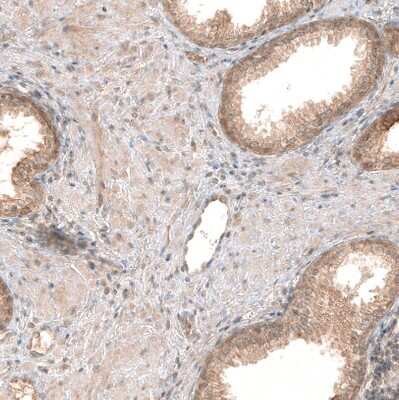 Immunohistochemistry-Paraffin: PIK3CA Antibody (CL8347) [NBP2-88915] - Staining of human prostate shows moderate cytoplasmic positivity in glandular cells.