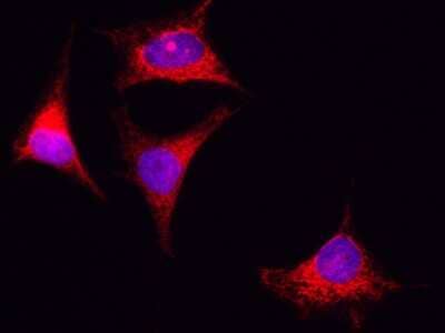 Immunocytochemistry/Immunofluorescence: PIK3CA Antibody [NBP2-98814] - Immunofluorescence staining of PIK3CA in HeLa cells. Cells were fixed with 4% PFA, permeabilzed with 0.3% Triton X-100 in PBS, blocked with 10% serum, and incubated with rabbit anti-human PIK3CA polyclonal antibody (1:5000) at 4C overnight. Then cells were stained with the Alexa Fluor(R)594-conjugated Goat Anti-rabbit IgG secondary antibody (red) and counterstained with DAPI (blue). Positive staining was localized to cytoplasm.