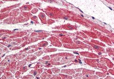 Immunohistochemistry-Paraffin: PIK3CA Antibody [NB100-55408] - Staining of paraffin embedded human heart with antibody at 5 ug/mL. Steamed antigen retrieval with citrate buffer pH 6, AP-staining.