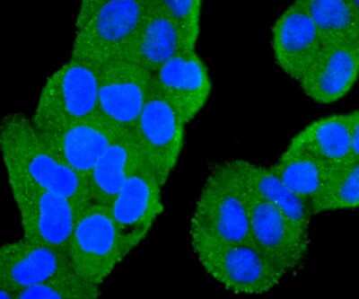 Immunocytochemistry/Immunofluorescence: PIK3CA Antibody (SJ0186) [NBP2-67059] - Staining PI 3 kinase p110 alpha in Hela cells (green). The nuclear counter stain is DAPI (blue). Cells were fixed in paraformaldehyde, permeabilised with 0.25% Triton X100/PBS.