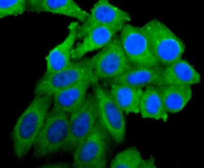 Immunocytochemistry/Immunofluorescence: PIK3CA Antibody (SJ0186) [NBP2-67059] - Staining PI 3 kinase p110 alpha in HepG2 cells (green). The nuclear counter stain is DAPI (blue). Cells were fixed in paraformaldehyde, permeabilised with 0.25% Triton X100/PBS.