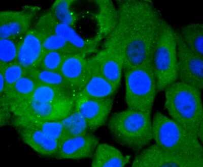 Immunocytochemistry/Immunofluorescence: PIK3CA Antibody (SJ0186) [NBP2-67059] - Staining PI 3 kinase p110 alpha in MCF-7 cells (green). The nuclear counter stain is DAPI (blue). Cells were fixed in paraformaldehyde, permeabilised with 0.25% Triton X100/PBS.