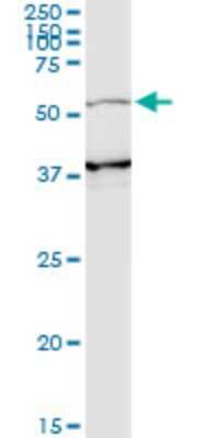 Western Blot: PIK3R3 Antibody (2F8) [H00008503-M02] - PIK3R3 monoclonal antibody (M02), clone 2F8. Analysis of PIK3R3 expression in human spleen.